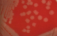 Бацилла сибирской язвы микробиология